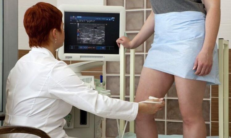 Koagulacja laserowa w leczeniu żylaków