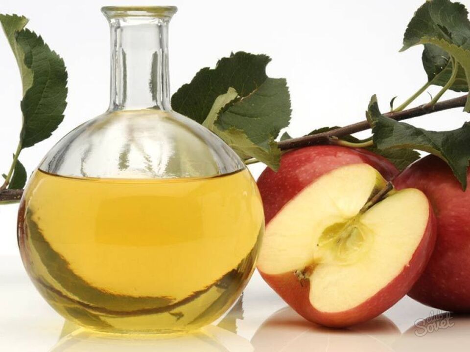 ocet jabłkowy na żylaki